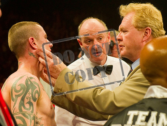 BOXING Burns