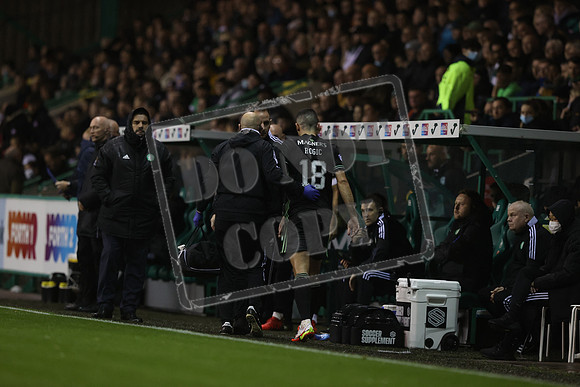 SOCCER Hibernian