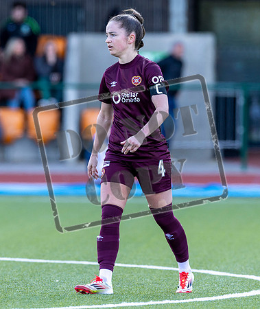 Hibs v Hearts
